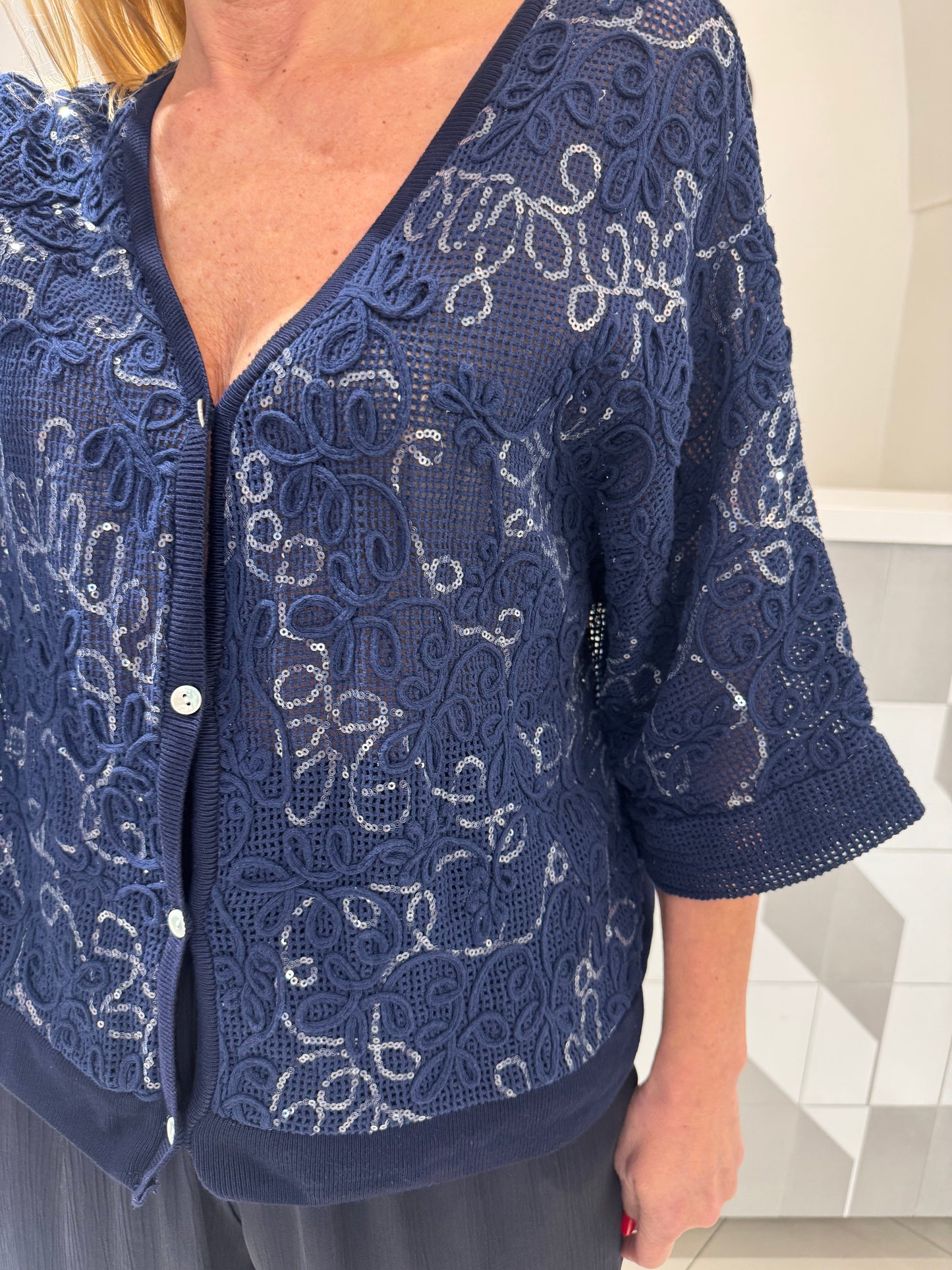 Kardiganas su žieručiais (P944)